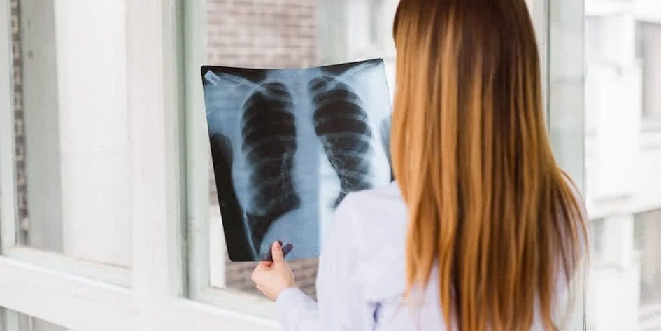 Akciğer Kanseri, Belirtileri ve Türleri Nedir?