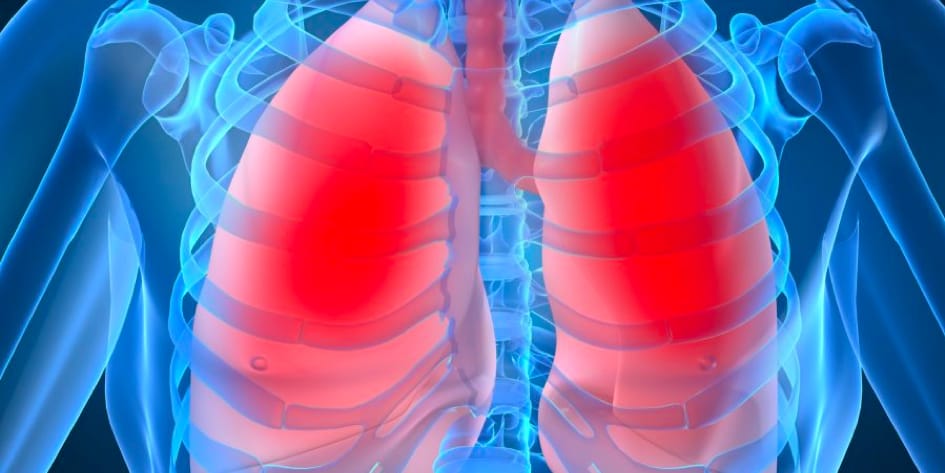 İnterstisyel Akciğer Hastalığı Nedir?